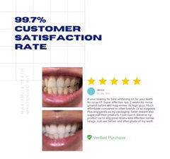 MAXI SMILE Ultra - Teeth Whitening Kit 2024 Model Professional Rechargeable Wireless 32 LED Light