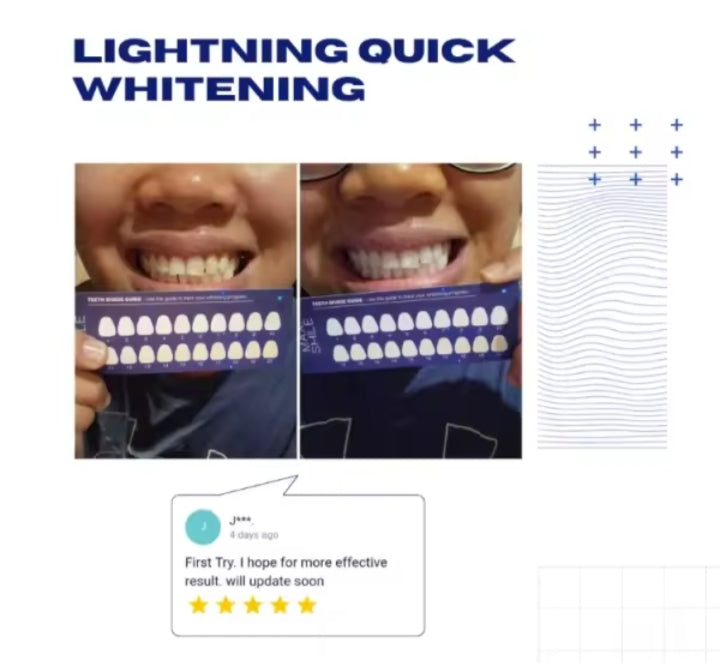 MAXI SMILE Ultra - Teeth Whitening Kit 2024 Model Professional Rechargeable Wireless 32 LED Light