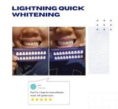 MAXI SMILE Ultra - Teeth Whitening Kit 2024 Model Professional Rechargeable Wireless 32 LED Light